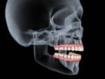 Restore Your Smile with All-on-4 Dental Implants in North Phoenix